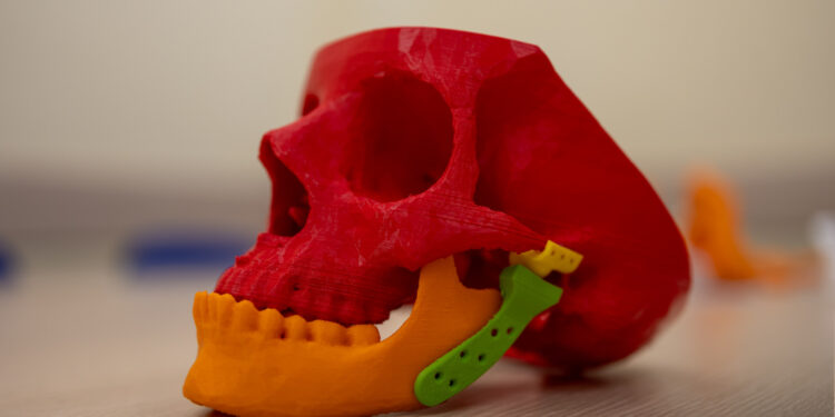 Politechnika Białostocka zgłosiła patent na implant stawu skroniowo-żuchwowego